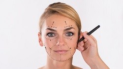 Vivace Device for Face Tightening & Wrinkle Removal