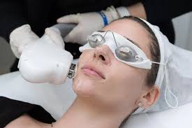 IPL Technique for Face