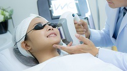 Laser Bleaching of Vellus Hair