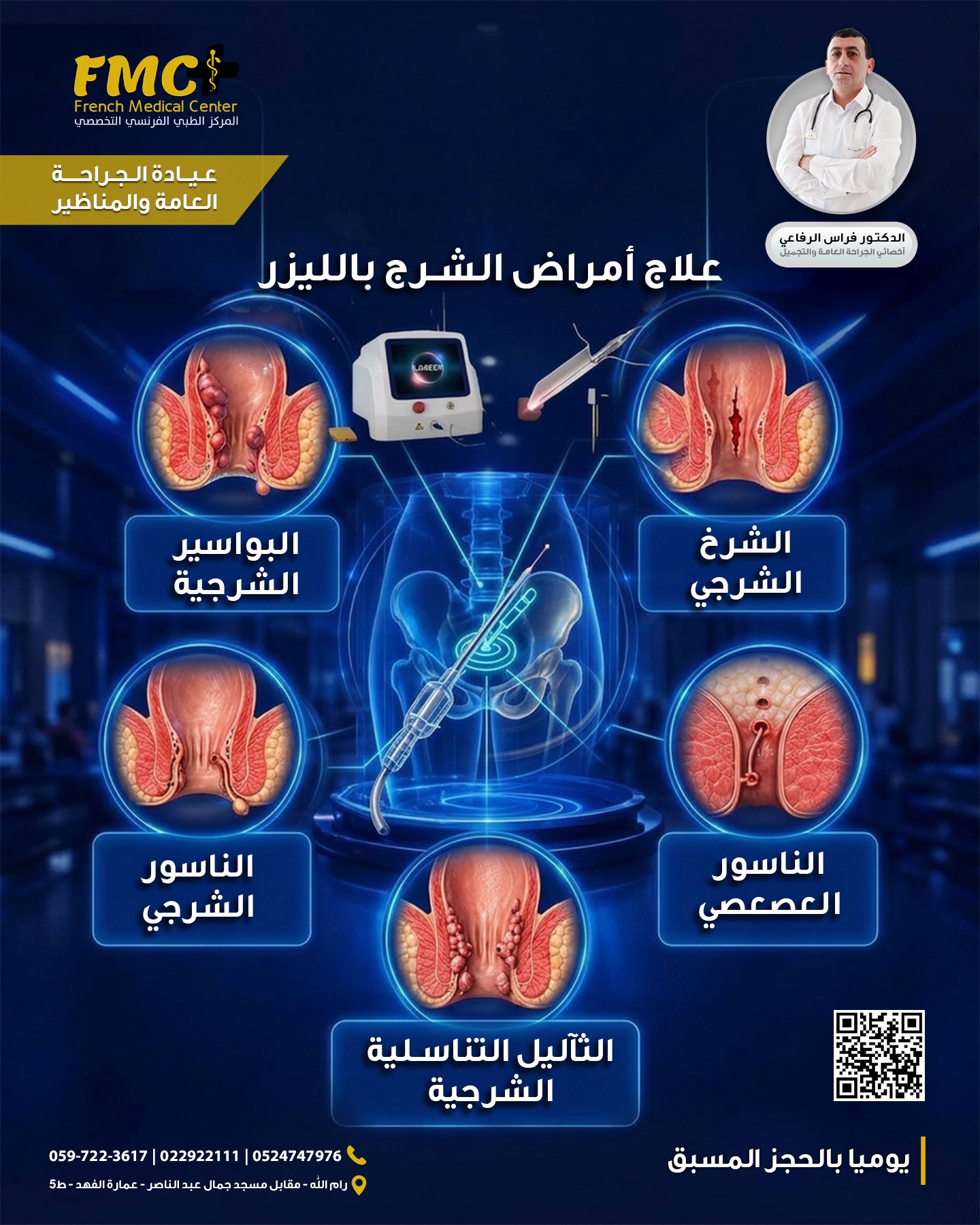 Laser Hemorrhoid Removal