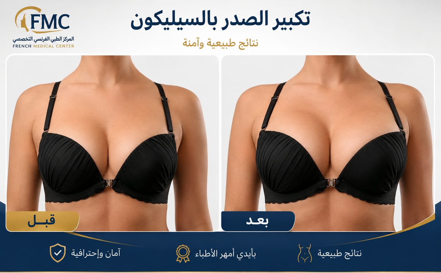 Silicone breast augmentation